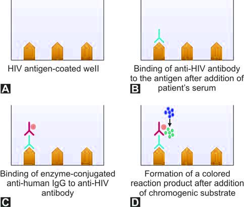 Figure 1197.5 Principle of ELISA test for anti HIV antibodies